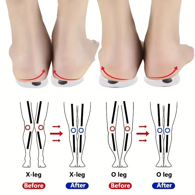 1 Pair Silicone Gel Foot Insoles X/O Shape with Magnet Heel Pad for Men And Women Foot Care Insert for Comfort