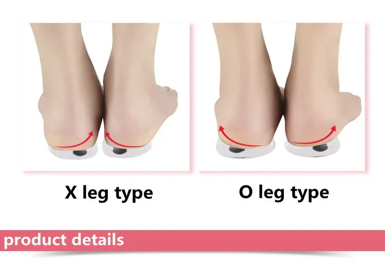 1 Pair Silicone Gel Foot Insoles X/O Shape with Magnet Heel Pad for Men And Women Foot Care Insert for Comfort