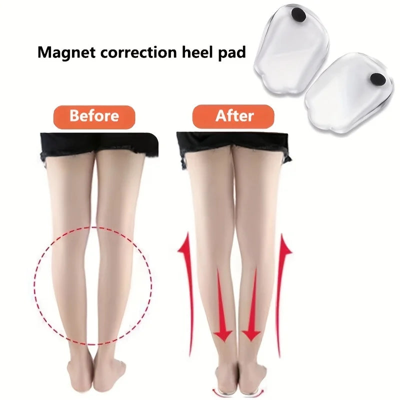 1 Pair Silicone Gel Foot Insoles X/O Shape with Magnet Heel Pad for Men And Women Foot Care Insert for Comfort