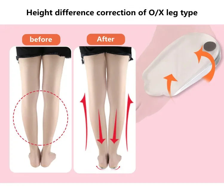 1 Pair Silicone Gel Foot Insoles X/O Shape with Magnet Heel Pad for Men And Women Foot Care Insert for Comfort